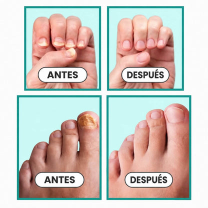 Suero Antifúngico