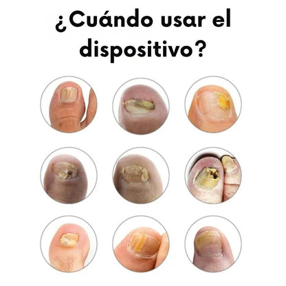 Dispositivo OrthoVital